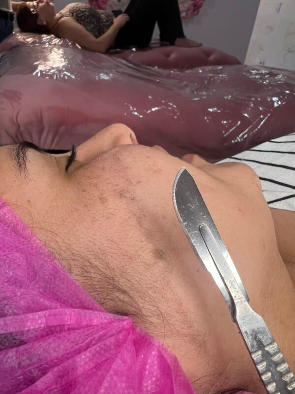 Dermaplaning