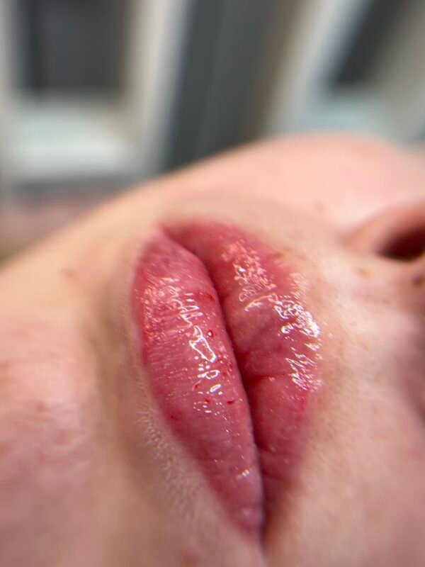 Pigmentação labial + revitalização - Image 3